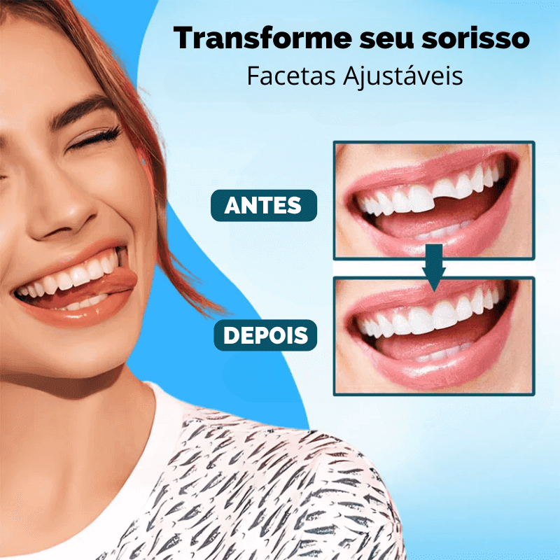 Facetas Dentárias Universal Smile